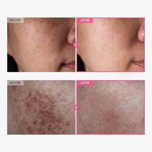 Soins de la peau coréens Tosowoong Arbutin 7% Acide tranexamique 4% Niacinamide Glutathion Correcteur de taches brunes Hydratant éclaircissant 50ml - Product Image 5