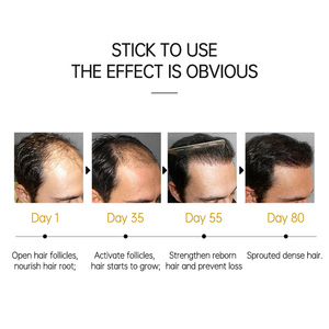 <strong>Biotin</strong> <strong>Hair</strong> Growth <strong>Oil</strong> Fast <strong>Hair</strong> Regrowth Serum Organic <strong>Hair</strong> Growth <strong>Oil</strong> - Product Image 5
