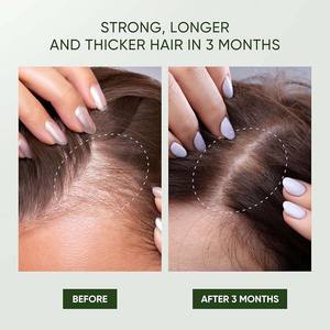 Champú de Romero para el Crecimiento del Cabello, Anticaspa, Cuidado del Cuero Cabelludo, Ingredientes Naturales, OEM/ODM Disponible para Todo Tipo de Cabello - Product Image 5