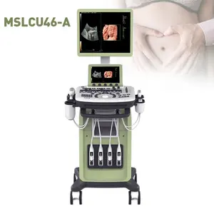 Máquina de ultrassom de carrinho de cor da china melhor qualidade, sistema de ultrassom de diagnóstico para clínica