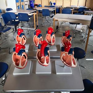 Doğumdan Beri Kalp Malformasyonu Modelleri Tıp Bilimi Modeli Anatomi Modeli Setleri Kalp Patolojisi Hastalığı Kalp Modeli Tıp Bilimi - Product Image 4