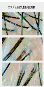 Analizador de Cuero Cabelludo Digital de 4 Rejillas con Aumento de 50x200x, Microscopio para Cabello, Detector de Folículos Pilosos - Product Image 4