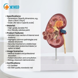 <span class=keywords><strong>Urología</strong></span> modelo anatómico médico PVC Enfermedad Renal estructura del corazón dispositivo de enseñanza celular suministro esencial para estudiantes - Product Image 1