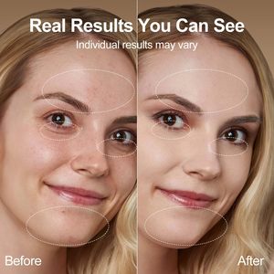 Xách tay nâng cấp cổ vẻ đẹp tất cả-trong-một khuôn mặt Massage công cụ với con lăn ngọc bích cho khuôn mặt và cổ - Product Image 4