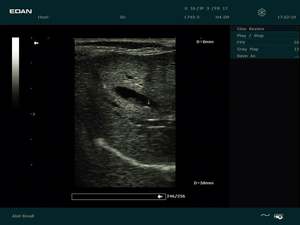 Échographe portable <span class=keywords><strong>Edan</strong></span> <span class=keywords><strong>Dus</strong></span> <span class=keywords><strong>60</strong></span>, appareil d'échographie BW, dispositif médical - Product Image 6