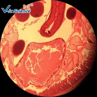 Microscope Prepared Slides Parasitology Set of 10 Pcs
