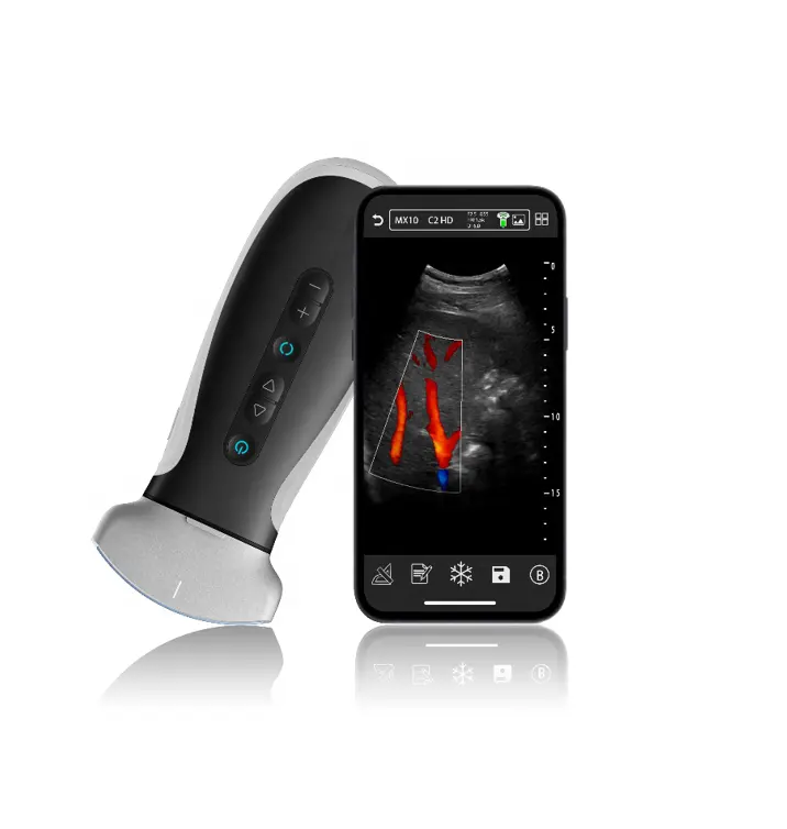 Android iOS Windows System App-based Pocket Wireless Color Doppler Ultrasound Scanner Wireless Pocket Ultrasound Scanner