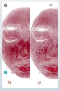 Sistema Analizador de Piel Inteligente con IA Profesional 2026 <span class=keywords><strong>JLM</strong></span>, Garantía de 2 Años, Pantalla Táctil de 21.5 Pulgadas, Control por iPad para Salón de Belleza - Product Image 3