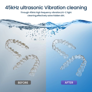 Nettoyeur à ultrasons amélioré pour prothèses dentaires, protège-dents, appareils orthodontiques, aligneurs, brosses à dents et bijoux – Capacité 380 ml - Product Image 6