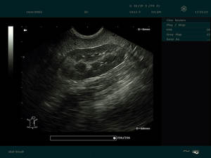 Échographe vétérinaire <span class=keywords><strong>portable</strong></span> <span class=keywords><strong>Edan</strong></span> DUS60 vétérinaire échographe échographe avec sonde rectale - Product Image 6