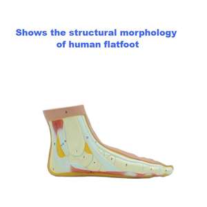 Modèle anatomique de pied plat humain-Aide à l'enseignement et à la recherche médicale - Product Image 3
