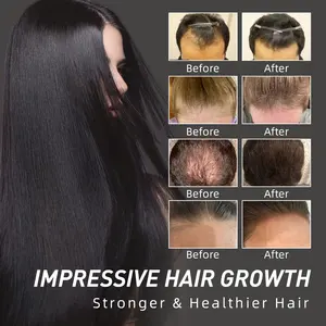 Private Label 100% olio di rosmarino naturale nutre il trattamento per la perdita dei capelli del cuoio capelluto biotina siero per la crescita dei capelli