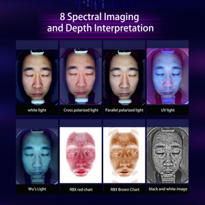 <b>Smart</b> AI Skin Analysis Machine with Face Imaging <b>Camera</b> and Skin Report System for Beauty Salon and Spa Center Use - Product Image 6
