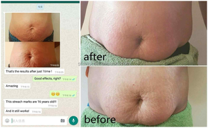 <span class=keywords><strong>ฉีด</strong></span>สลายไขมันสตรอว์เบอร์รี่ 6D ไลโปเลเซอร์ โมอนจาโร 5 มก. <span class=keywords><strong>ฉีด</strong></span>ลดน้ำหนัก ครอบคลุมทั่วร่างกาย แสงสีแดงสูงสุดสำหรับการสลายไขมัน - Product Image 4