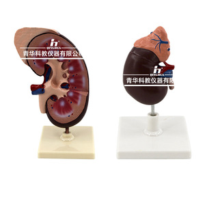 Modèle de rein humain ; anatomie du rein ; modèle agrandi de la glande surrénalette ; rein malade ; anatomie des organes internes humains. - Product Image 3