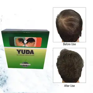 Ücretsiz örnekleri Yuda saç büyüme sprey Anti saç dökülmesi ürünleri!