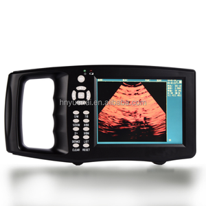 Medische Benodigdheden Medische Echografie Machine Veterinaire Draagbare Echoscanner Kleur Echografie Machine Hete Verkoop Goede Prijs - Product Image 3