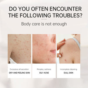 Антибактериальная серная ванночка DDO, лекарственное средство для мытья тела, жидкое серное мыло от акне - Product Image 4