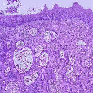 Ensemble de 100 lames de microscope préparées sur le thème de la pathologie humaine, utilisées par les médecins et les étudiants en médecine - Product Image 3