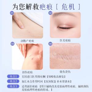 Crème médicale au gel de silicone à l'acide hyaluronique Kefuyanbenshu pour l'élimination des cicatrices de césarienne, pansement en gel de silicone - Product Image 4