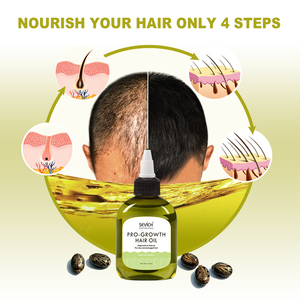 <span class=keywords><strong>Aceite</strong></span> para el Crecimiento del Cabello Sevich Quality Wild Growth, Suero Herbal Suave para el Crecimiento del Cabello con Efecto Mágico para el Crecimiento <span class=keywords><strong>de</strong></span> las <span class=keywords><strong>Pestañas</strong></span> - Product Image 6