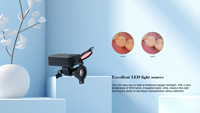 Lampe frontale HL8260 combinée à une loupe chirurgicale colorée SLT, conception intégrée sans fil, filtre jaune