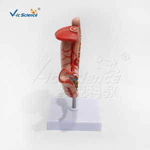 Modèle anatomique gastrique pathologique de grande taille ; outil pédagogique pour l'étude des structures pathologiques de l'estomac humain. - Product Image 2