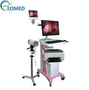 Dijital elektronik kolposkop taşınabilir HD vajina resimleri video kolposkop ucuz fiyat DVC5004