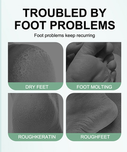 Set <span class=keywords><strong>de</strong></span> Mascarillas para Manos y Pies UUKKG, Calcetines con Forro <span class=keywords><strong>de</strong></span> Gel para Piel Seca y Agrietada, Tratamiento <span class=keywords><strong>de</strong></span> Spa Nocturno, Lavables y Ecológicos UU4961 - Product Image 6