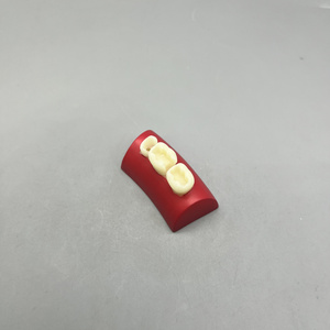 Dental Cavity Filling Model - Resin Material for Root Canal Filling and <strong>Inlay</strong> Practice - Three <strong>Teeth</strong> Model - Product Image 5