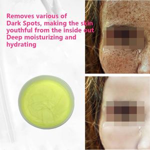 Crème éclaircissante intensive anti-taches brunes, correcteur de taches de rousseur, crème éclaircissante pour la peau, crème pour le visage pour éliminer les taches de mélasma, les taches pigmentaires, le <span class=keywords><strong>peeling</strong></span>, Kg Cosmétique - Product Image 2