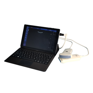 Yeni varış renkli Doppler ücretsiz taşınabilir Veasi tarama taşınabilir ultrason renkli Doppler makinesi USB ultrason dışbükey prob - Product Image 1