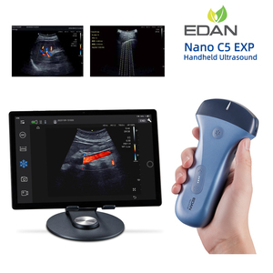 Échographe <span class=keywords><strong>portable</strong></span> sans fil <span class=keywords><strong>Edan</strong></span> Nano C5 EXP avec sonde convexe pour diagnostic abdominal <span class=keywords><strong>portable</strong></span> - Product Image 2