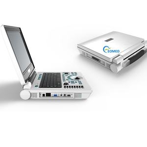 Harga pabrik Notebook sonografi pemindai Ultrasound Laptop hitam dan putih mesin Ultrasound dokter hewan BW30B - Product Image 4