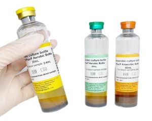 해피어 빠른 검사 시약 검사실 혈액 배양 병 플라스틱 미생물 빠른 검사 시약 병 - Product Image 1