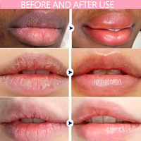 Sérum Lèvres Rose Contre l'Hyperpigmentation: Traitement Gloss Éclaircissant Rapide, Exfoliant et Repulpant pour Hommes et Femmes