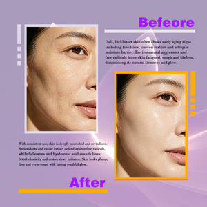 <span class=keywords><strong>Crème</strong></span> <span class=keywords><strong>CC</strong></span> hydratante <span class=keywords><strong>anti</strong></span>-<span class=keywords><strong>âge</strong></span> au fullerène CAVIAR, <span class=keywords><strong>crème</strong></span> raffermissante pour la peau, <span class=keywords><strong>anti</strong></span>-oxydation profonde, nourrit, restaure, hydrate G - Product Image 4