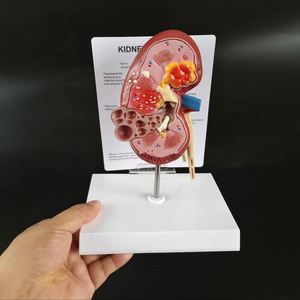 KyrenMed umano malato di anatomia del rene con calcoli urinari tumori malattia policistica a grandezza naturale modello di rene patologico - Product Image 6