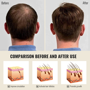 Shampoings pour la repousse des cheveux, marque privée, cheveux plus épais et couverture du cuir chevelu, produits de soin des cheveux pour hommes, shampoing stimulant la croissance - Product Image 4