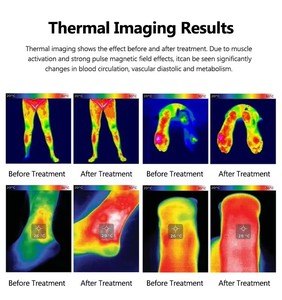 Microcurrent Body Shaping <b>Machine</b> Hot Compress Knee Relaxing <b>Massager</b> Knee Pads Physiotherapy Pain Relief - Product Image 4