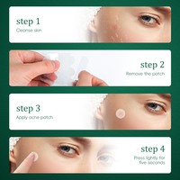 Patchs Hydrocolloïdes Personnalisés pour l'Acné avec Hydratant au Thé Vert, Marque Privée, pour le Traitement des Imperfections et des Boutons, 48 Unités