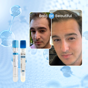 OEM 10ml 12ml <span class=keywords><strong>15ml</strong></span> saç büyüme santrifüj trombosit zengin plazma <span class=keywords><strong>PRP</strong></span> tüp teşvik - Product Image 5