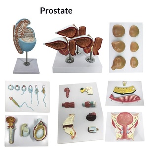 Modelo de anatomía renal ampliado, glándulas suprarrenales, riñón enfermo, modelo anatómico de órgano interno humano para escuelas de ciencias médicas - Product Image 3