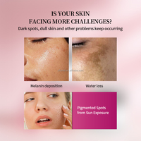 Crème Visage Anti-Acné et Éclaircissante à l'Arbutine 7% + Acide Tranexamique 4% et Niacinamide, Anti-Taches Brunes, Soin Blanchissant, Marque Privée