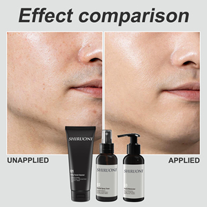Marque privée Kit de soins de la <span class=keywords><strong>peau</strong></span> pour hommes avec contrôle de l'huile Rafraîchissement Nettoyant pour le <span class=keywords><strong>visage</strong></span> Hydrater la sécrétion d'huile Ensemble de soins de la <span class=keywords><strong>peau</strong></span> - Product Image 3