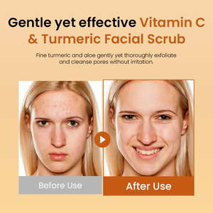 <span class=keywords><strong>Gommage</strong></span> éclaircissant pour le visage à la vitamine C au curcuma Huile d'avocat Vitamine E Aloe Vera pour <span class=keywords><strong>peau</strong></span> sujette à l'acné Réduit l'inflammation - Product Image 6