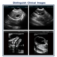 Guide de ponction pour lithotripsie, écran médical 15 pouces, scanner à ultrasons, SSD 128 Go, onde pulsée pour diagnostics chirurgicaux