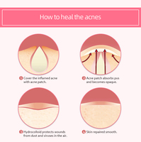 Patchs d'hydratation personnalisés OEM/ODM contre les boutons d'acné et les imperfections sur les boutons, vente en gros