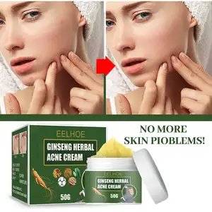 Acne Verwijdering Crème Behandeling Acne Litteken Krimpen Poriën Olie Controle Whitening Hydrateren Gezicht Ginseng Kruid Acne Huidverzorging