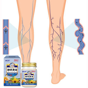 शिराओं की भीड़, प्रमुख शिरा, फैलाव, सुन्नता, दर्द, सूजन, पैरों में वैरिकाज़ नसें. - Product Image 4